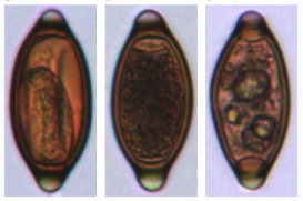 Trichuris suis parasite eggs analyzed by OvaSpec